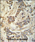 MRAP Antibody (N-term)